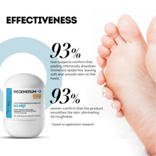 Load image into Gallery viewer, Regenerum regenerative enzymatic peeling for heels, roll-on 50 ml
